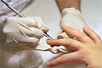 Cindy trycker tillbaka nagelbanden. Nageln ser längre ut då.