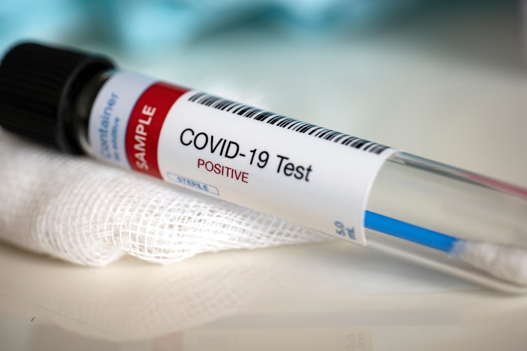 Positivt covid-test (genrebild).