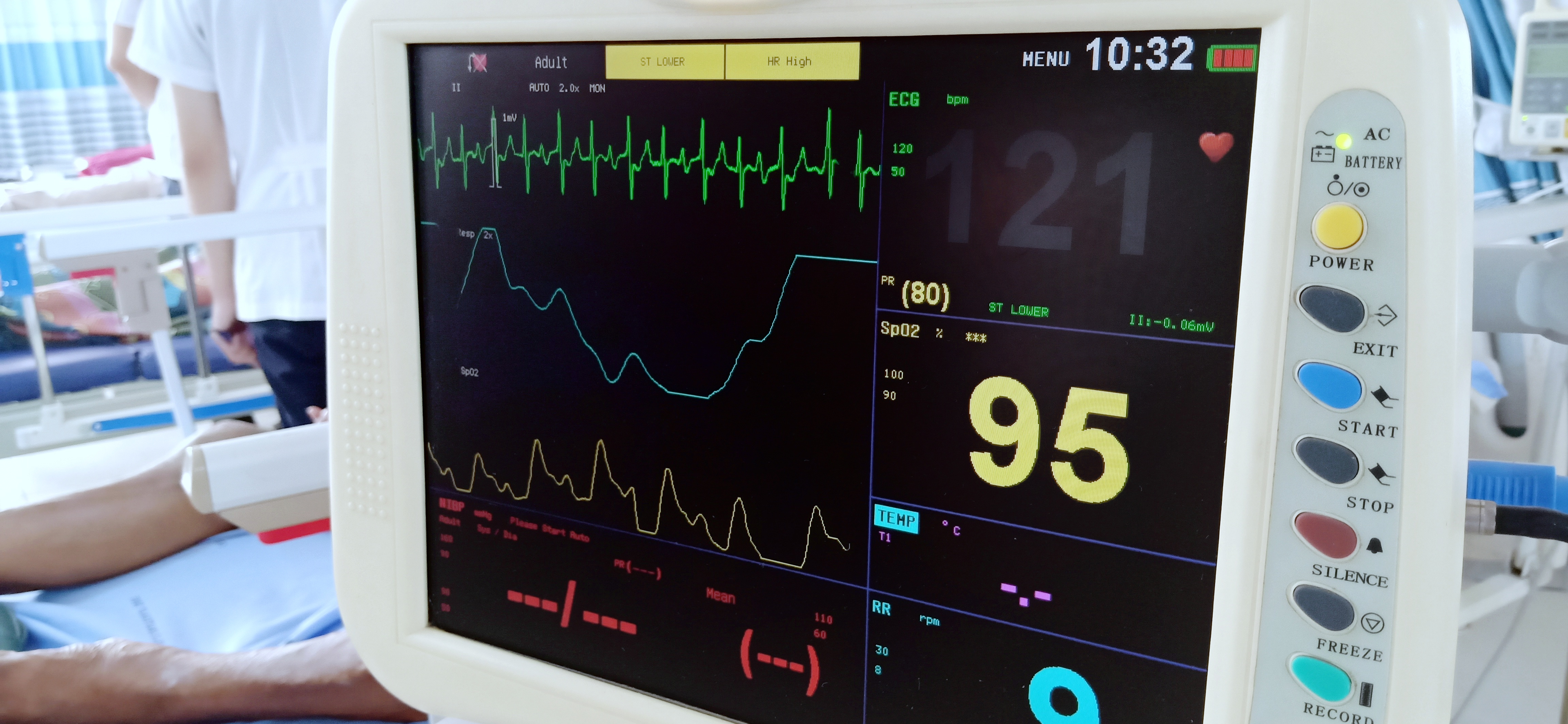 Skärmen på en EKG-maskin
