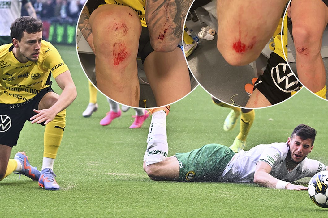 Mjällbys Colin Rösler och Hammarbys Viktor Dukanovic i en match där spelarnas skador dokumenterades av Mjällbys sportchef Jacob Lennartsson.