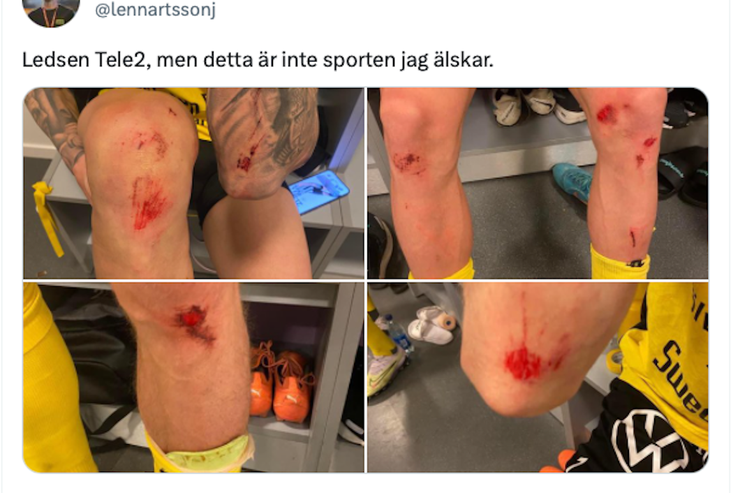 Jacob Lennartssons tweet efter matchen mot Hammarby.