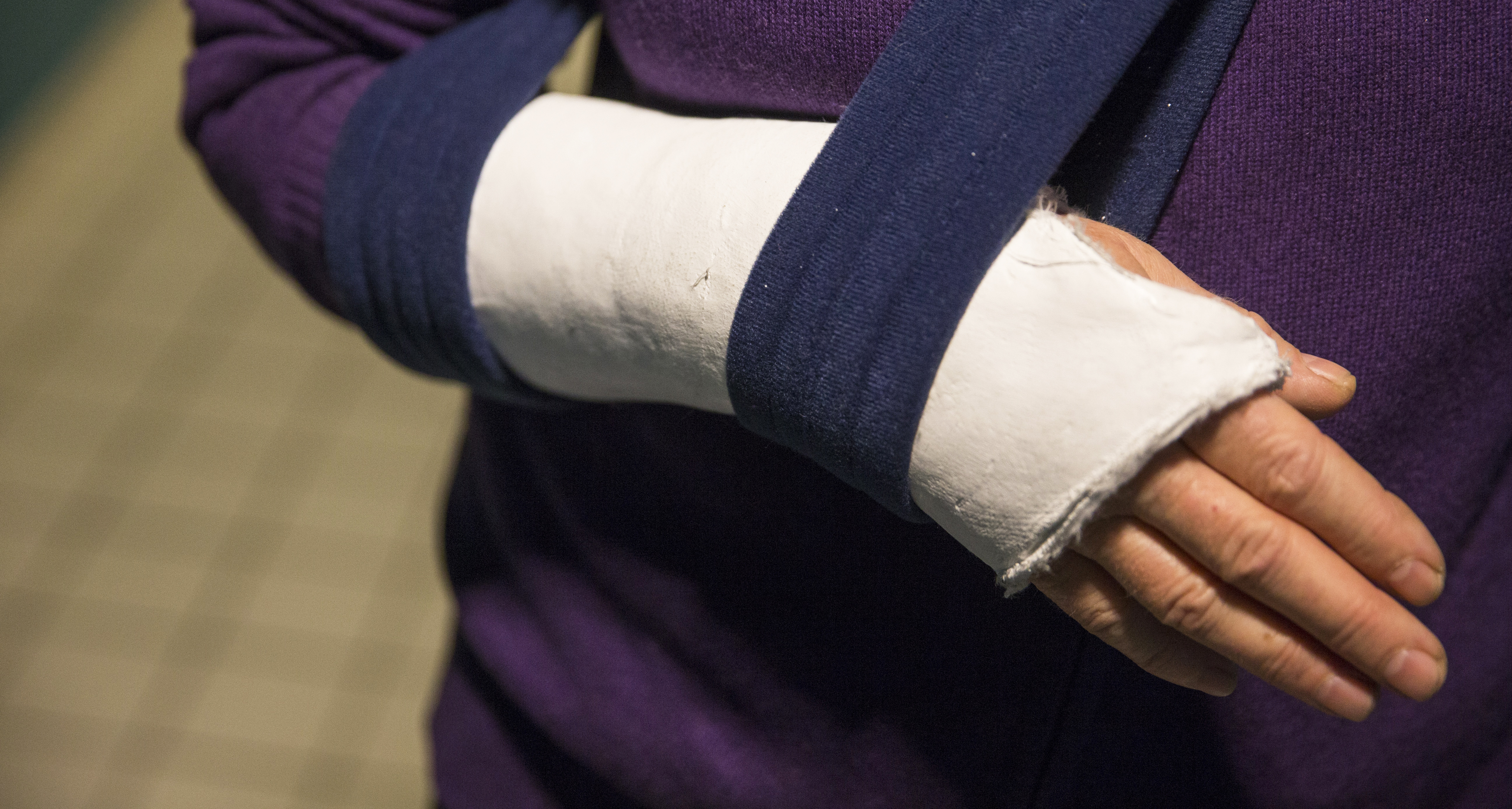 Gipsad arm Arbetsskada