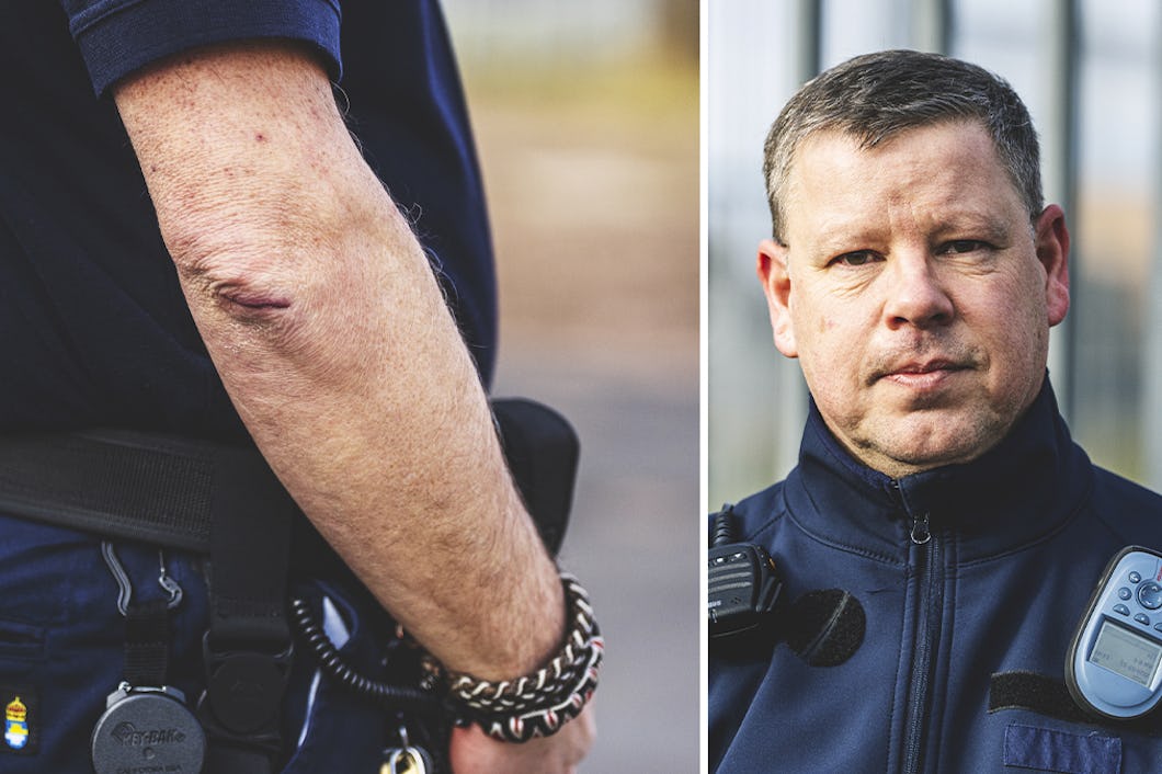 En delad bild som visar ett ärr på Mikael Anderssons armbåge till vänster och ett porträtt av Mikael Andersson till höger.