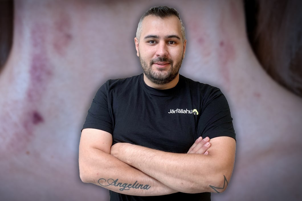 Alper Etirli står med armarna i kors. I bakgrunden på bildmontaget syns en kvinnas hals med blåmärken.