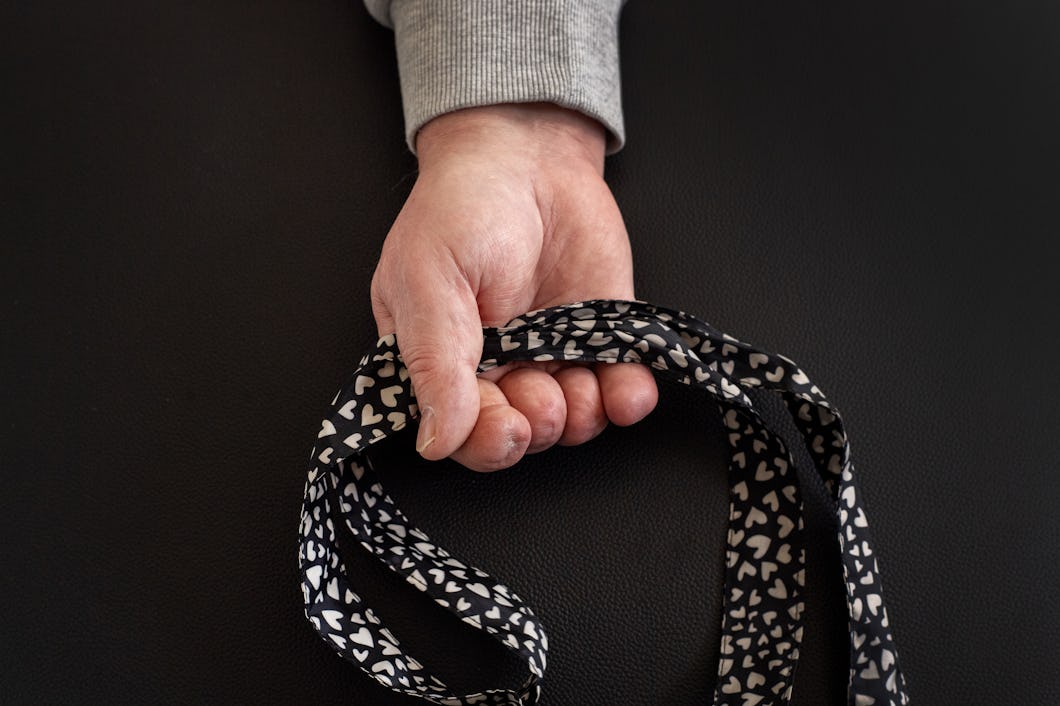 En hand med fyra avkortade fingrar håller i ett handtag till en tygkasse.
