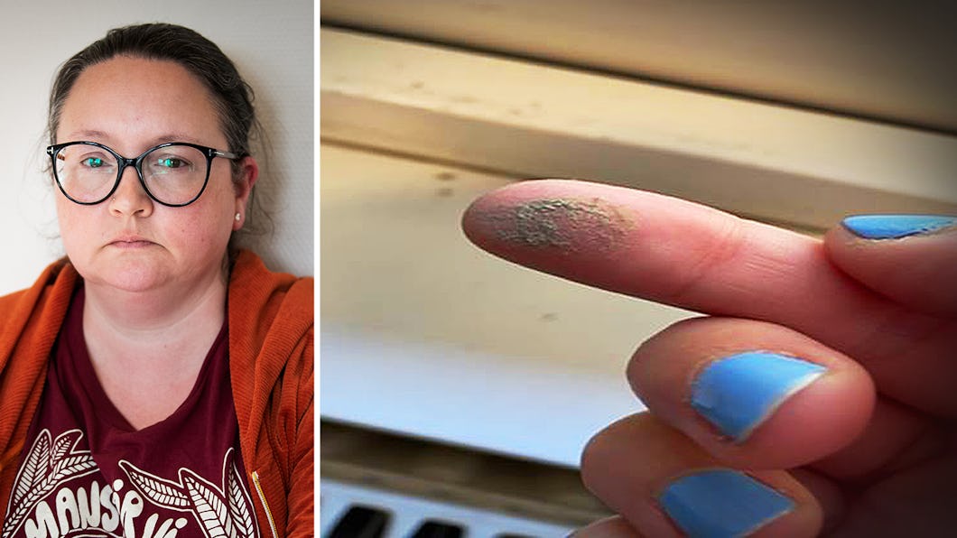 Kim Eriksson är allvarlig och ser in i kameran. Bredvid henne syns ett närbildsfoto av ett finger med blått nagellack, där det finns smuts på fingertoppen.
