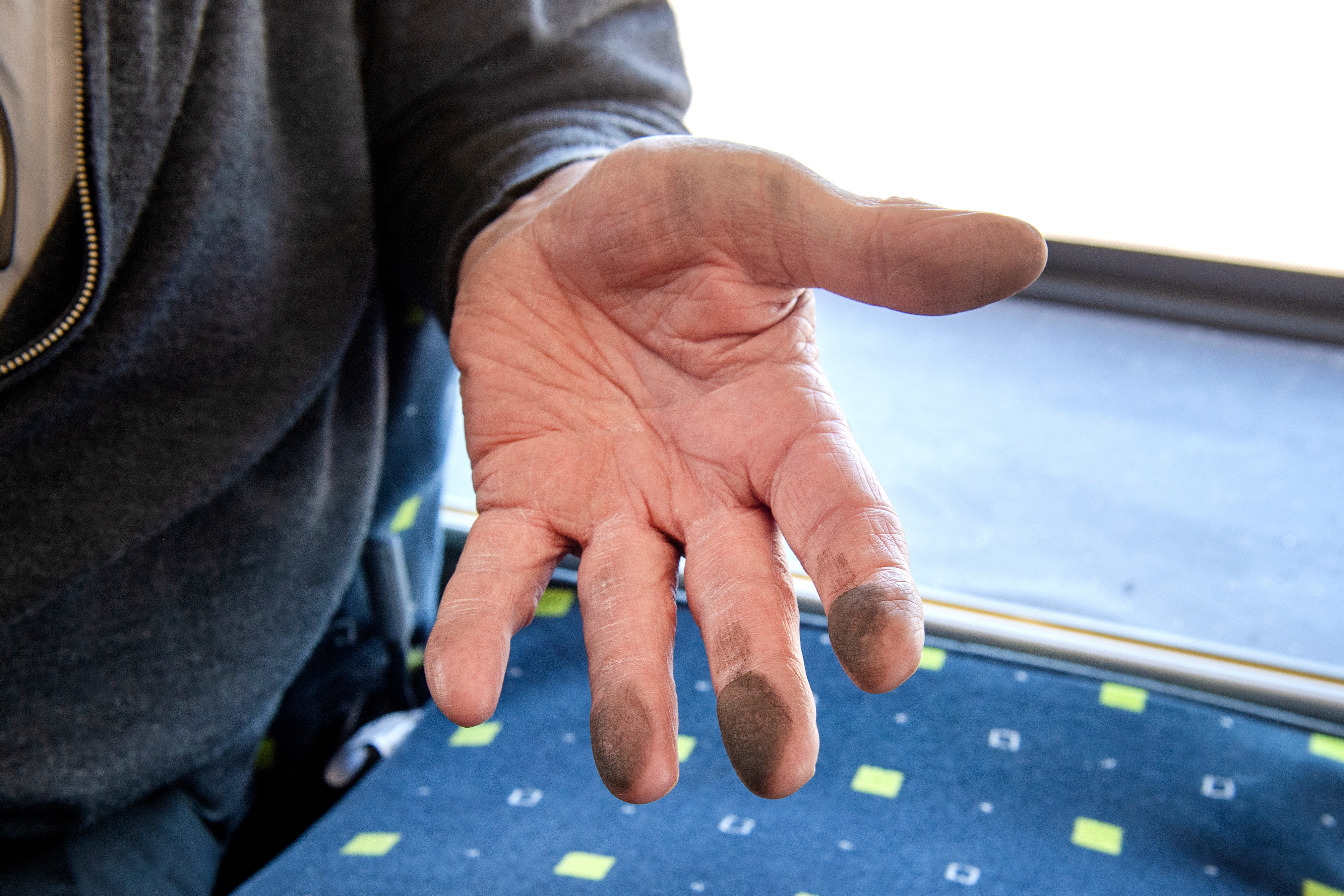 En person sträcker fram handen och visar fingrar täckta av smuts eller fett, samtidigt som han sitter på en blå sitter med gröna och vita fyrkanter.