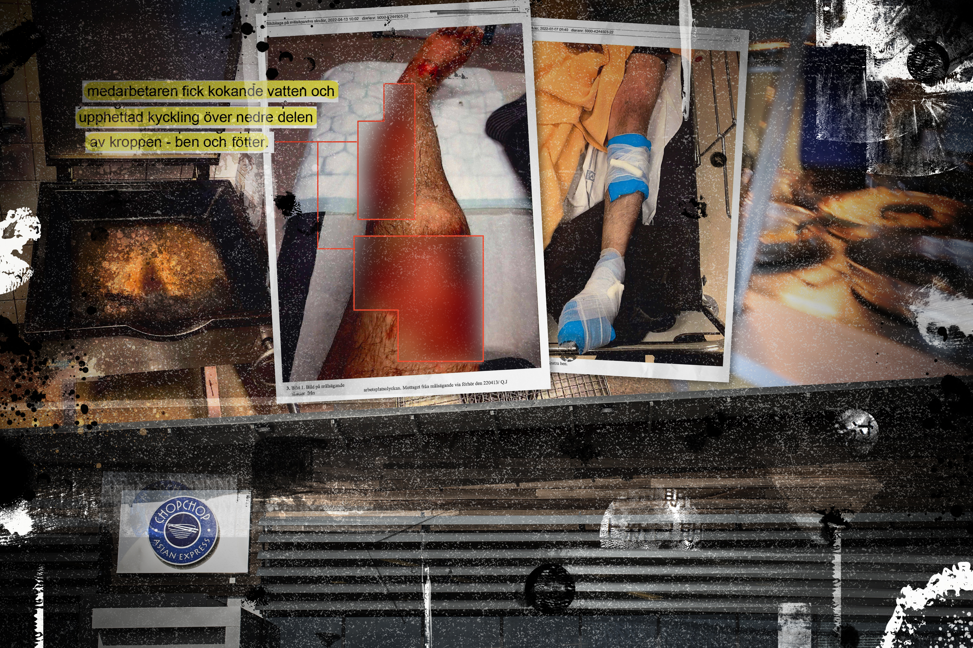 Ett collage med en brännskada på ett ben, en skylt där det står Chopchop. En beskrivning där det står hett vatten och kyckling.