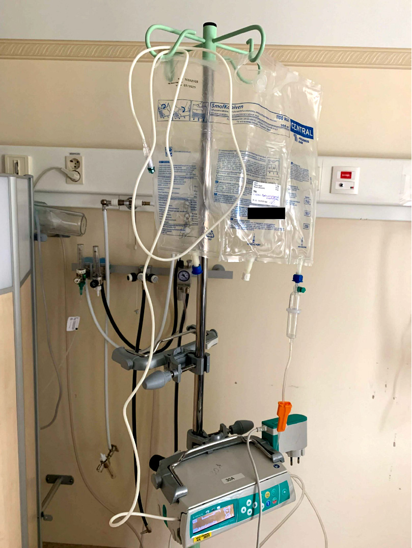 Ett droppställ med flera upphängda vätskepåsar, slangar, en infusionspump och medicinsk utrustning mot en beige vägg.