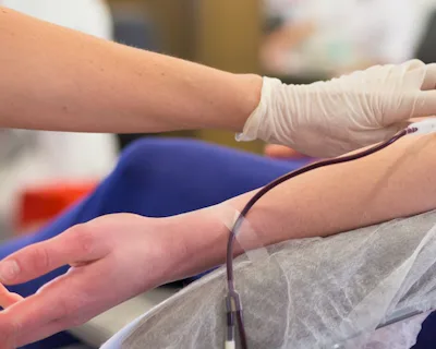 melanotan biverkningar Barbiedrogen melanotan – ny nätdrog med riskabla följder – Läkartidningen