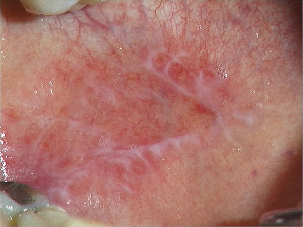 Yalangoch mukla Yalangoch mukla