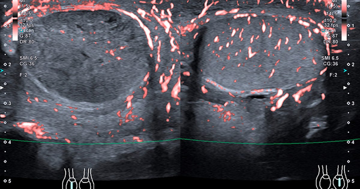 yalangoch mashhurlar panjur Kimga mushukimni yalashiga ruxsat berishim kerak?