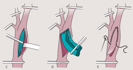 Pul uchun kokraklaringizni tomosha qiling va korsating Pul uchun kokraklaringizni tomosha qiling va korsating