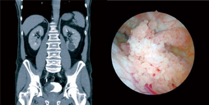 Qalin sikli yigitlarning fotosuratlari