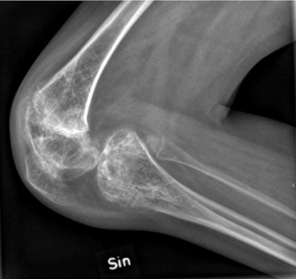 Keksa va semiz odamlarning porno videolari