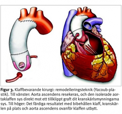 Ikki uchun bir fallus bilan porno