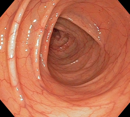 Ogil va ona ortasidagi yashirin jinsiy aloqa