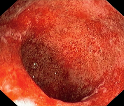 Porno rus xotini bir portlash bor