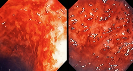 Yin Yang qoshiqchi porno