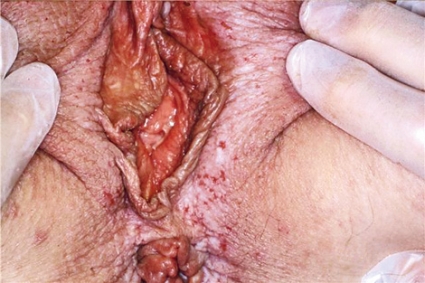 Chechen jinsiy aloqa video