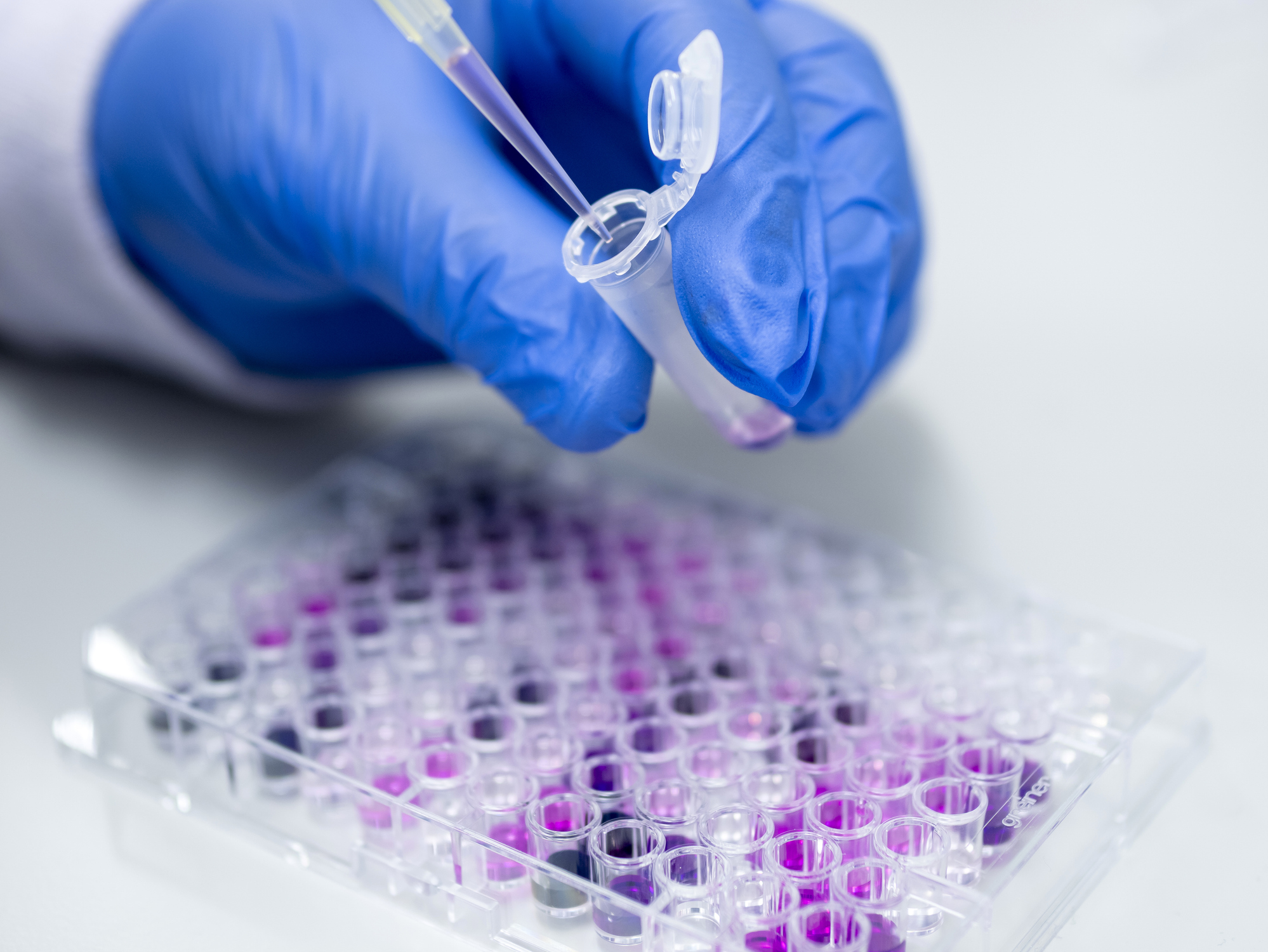 På grund av den nedåtgående trenden gav regeringen i mars i år Läkemedelsverket i uppdrag att på nationell nivå sammanställa och tillhandahålla statistik avseende kliniska prövningar i Sverige.